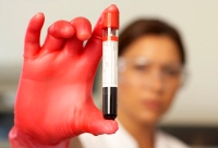 blood_vial